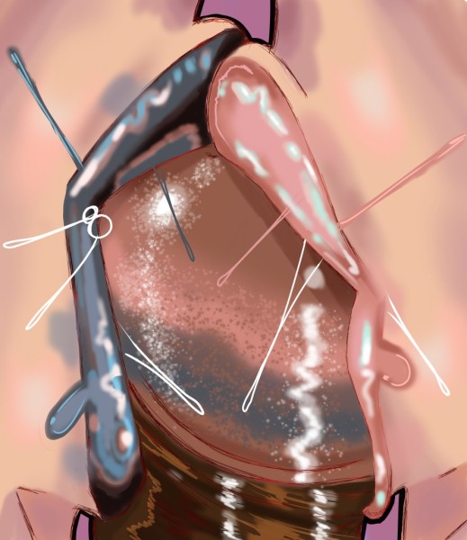 Psylocke and Magik x blade 2